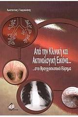 Από την κλινική και ακτινολογική εικόνα ...στο βρογχοσκοπικό εύρημα