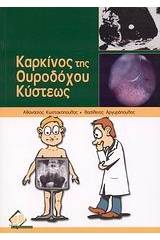 Καρκίνος της ουροδόχου κύστεως