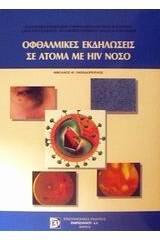 Οφθαλμικές εκδηλώσεις σε άτομα με HIV νόσο