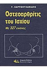 Οστεοαρθρίτις του ισχίου