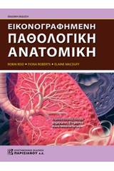 Εικονογραφημένη παθολογική ανατομική