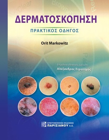 Δερματοσκόπηση